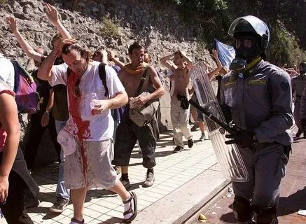 Injured people