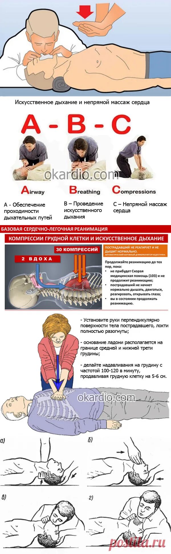 Непрямой массаж сердца и искусственное. Искусственное дыхание и непрямой массаж. Искусств дыхание и непрямой массаж сердца. Массаж сердца и искусственное дыхание