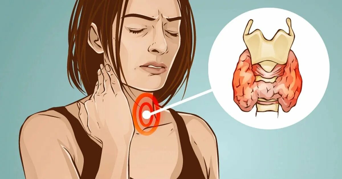 Симптоматика щитовидной железы. Нарушение функции щитовидной железы.