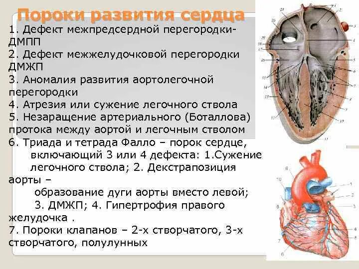 Врожденные пороки сердца дефект межпредсердной перегородки. Общие принципы развития сердца пороки развития. порок сердца межпредсердной перегородки. пороки развития межпредсердной перегородки. дефект межпредсердной перегородки классификация.