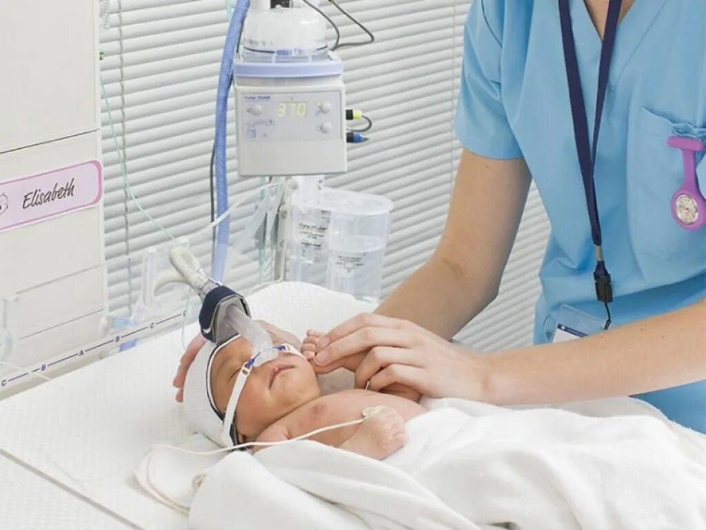 Аппарат ИВЛ реанимация новорожденных. CPAP ИВЛ для новорожденных. Аппарат ИВЛ неонатальный. Сипап аппарат для новорожденных недоношенных детей.
