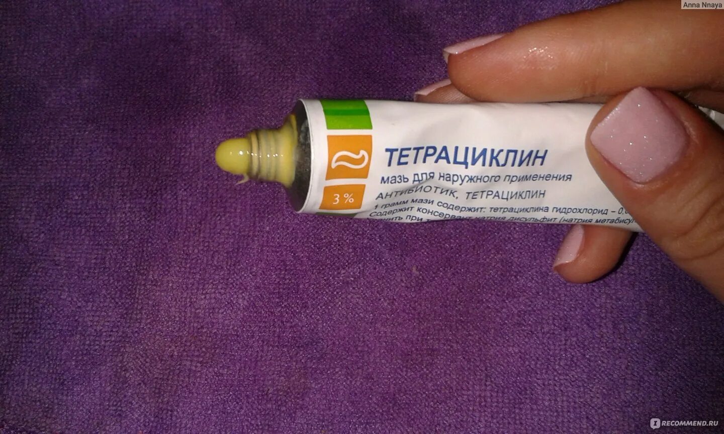 Как правильно мазать тетрациклиновой мазью