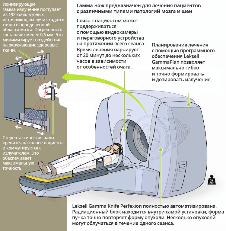 Менингиома гамма нож. Стереотаксическая радиохирургия гамма-нож. Гамма нож стереотаксическая рама. Гамма нож строение. Лучевая терапия гамма нож.