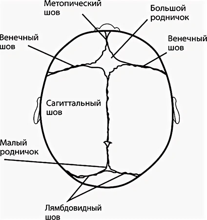Швы и роднички. Метопический шов черепа. Расхождение швов черепа. Стреловидный шов черепа.