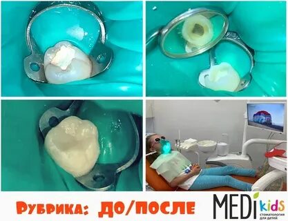 Детский меди киров