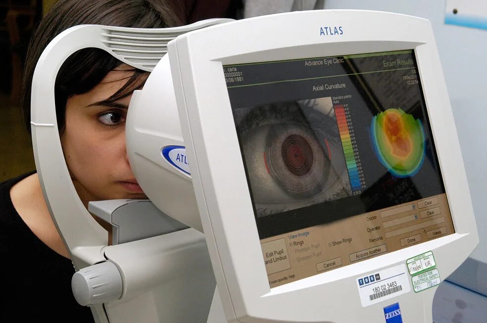 Глаз т в. Кератоконус кератометрия. Компьютерная кератотопография глаза. Кератоконус авторефрактометрия. Кератотопография аппарат.