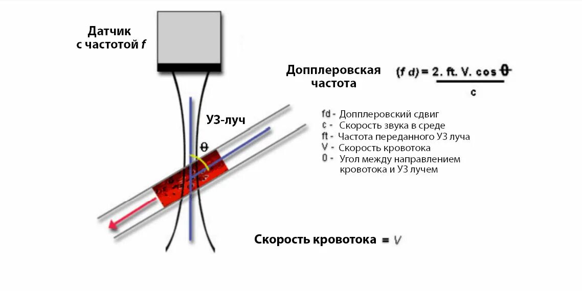 Для какого из приведенных сосудов необязательна установка. Доплеровский датчик УЗИ. Эффект Доплера при УЗИ. Датчик для УЗДГ сосудов. УЗИ допплеровский аппарат.