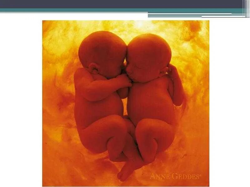 двойная беременность с разными сроками. чувствую беременность двойней. чувствую беременность двойней. живот с двойней по месяцам. чувствую беременность двойней.