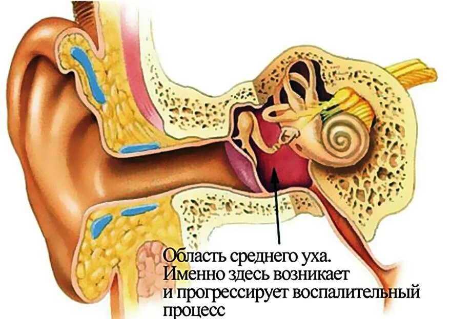 Шум в ушах при насморке