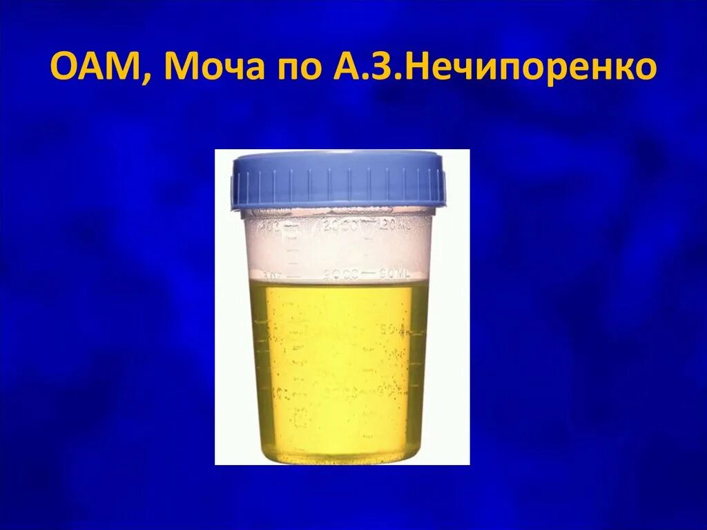 Оам по нечипоренко. Нечипоренко моча. Сбор мочи по Нечипоренко. Моча по Нечипоренко цвет.