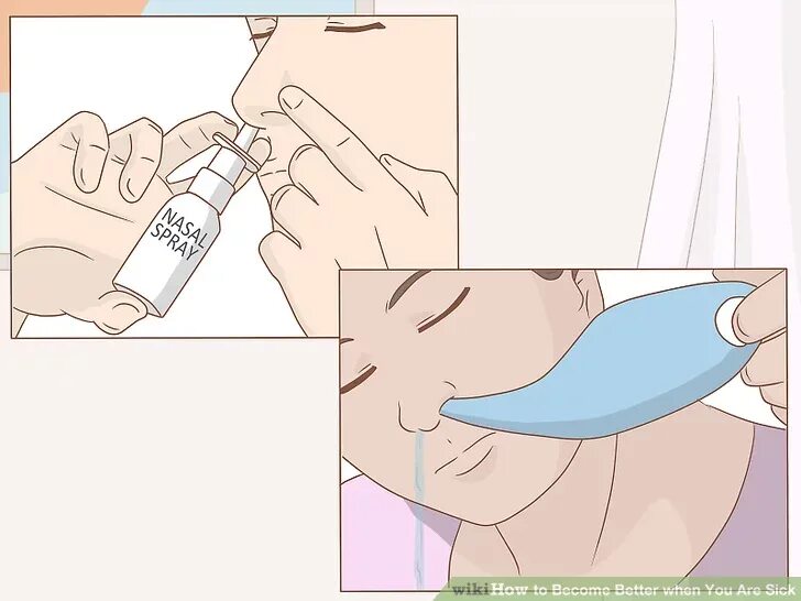 Как правильно промыть нос шприцом взрослому. Схема промывания носа. Промывание носа солевым раствором шприцом. Промывание носа солевым раствором из шприца. Шприц для промывки носа.