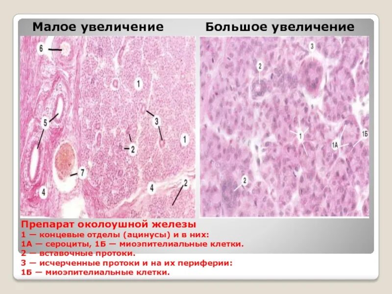 Препарат околоушной железы. Околоушная железа гистология препарат. Исчерченный проток околоушной слюнной железы гистология. Околоушная слюнная железа гистология. Клетки слюнных желез гистология.