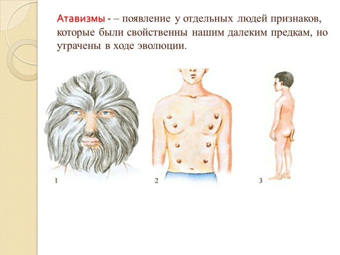 К атавизмам относятся. Атавизмы и рудименты человека. Аталвизмы ууу человека. Проявление атавизма у человека.