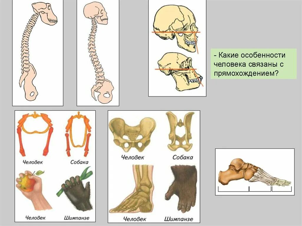 Изменения в скелете человека в связи с прямохождением. Особенности скелета человека связанные с прямо хождение. Особенности человека связанные с прямохождением. Особенности человека связаны с прямохождением.