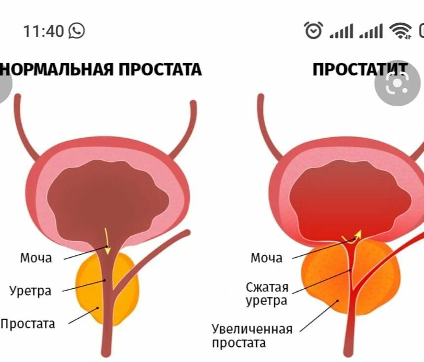 Простата находится на глубине