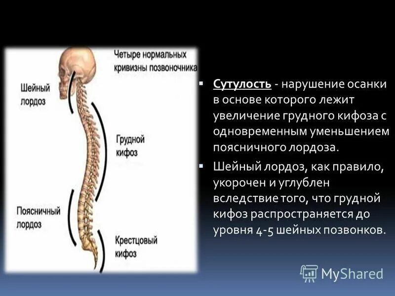 патологический лордоз.