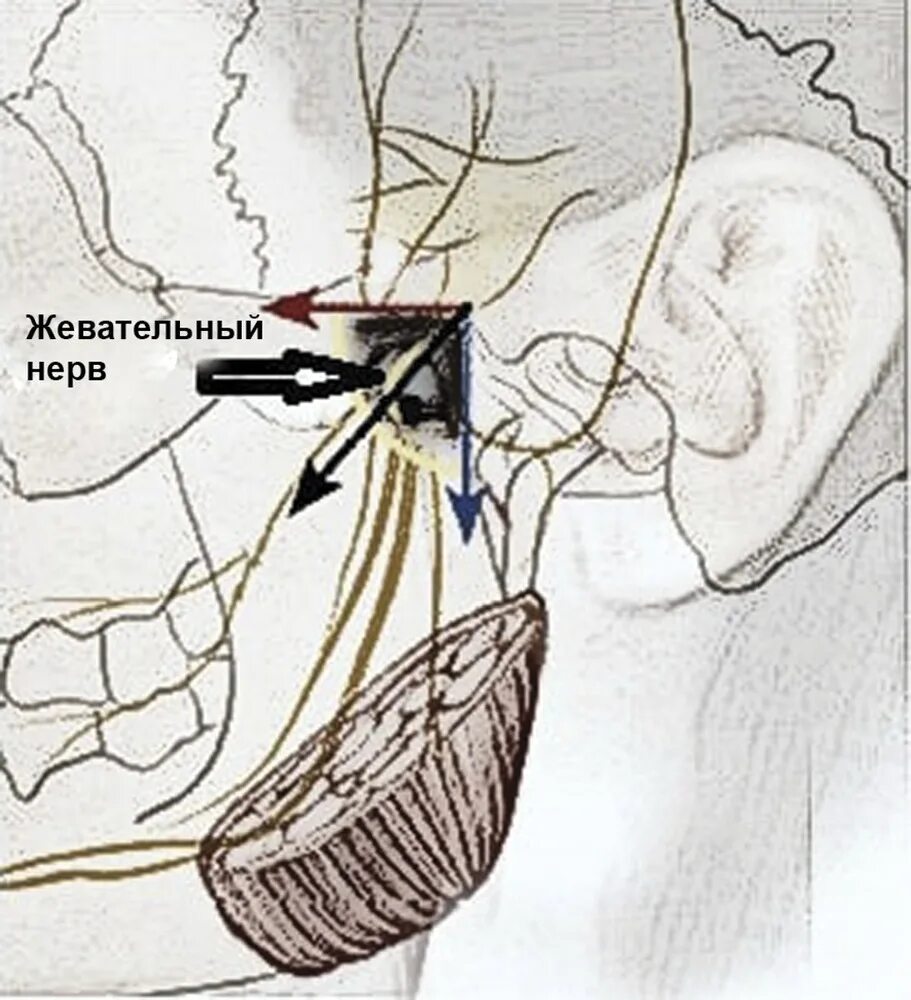 Радиочастотная ризотомия тройничного нерва. Неврит нижнечелюстного нерва. Тройничный нерв анатомия воспаление. Корешок тройничного нерва. Левый лицевой нерв