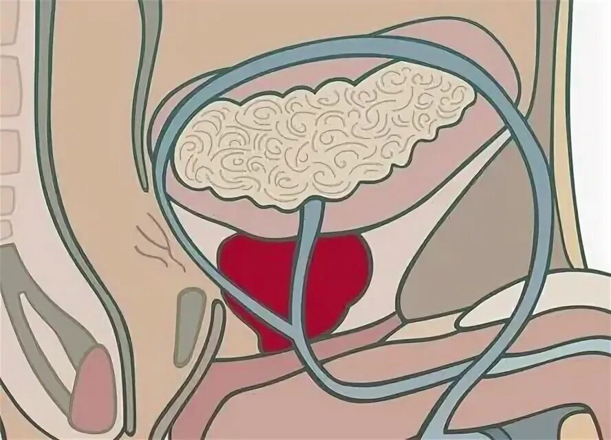 Стимуляция предстательной железы. Массаж предстательной железы. Простата рисунок. Массаж простаты простатит.