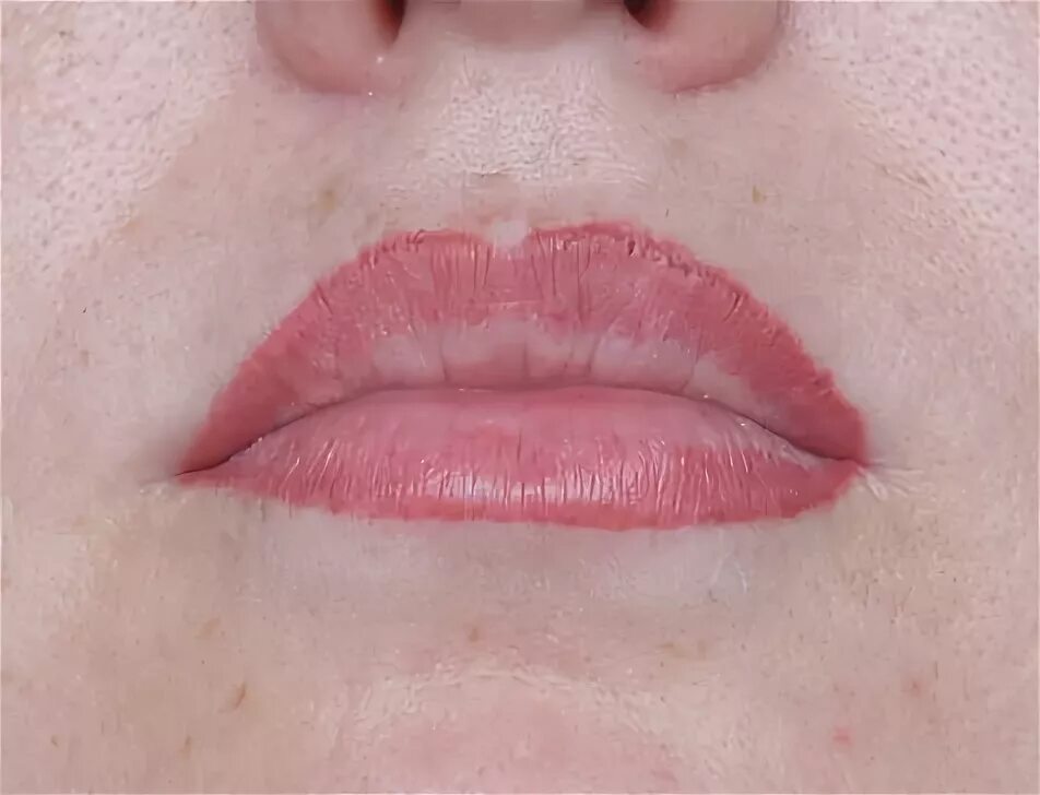 Отек губ после перманентного. Перманентный макияж губ. Губы после перманентного макияжа. Перманент губ. Неудачный перманентный макияж губ.