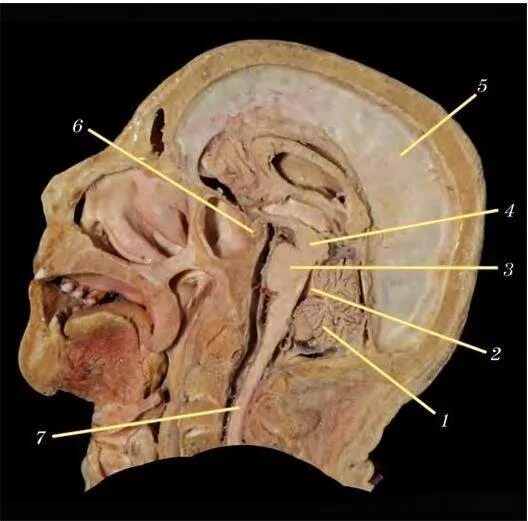 Мрт черепных нервов. Сагиттальный распил черепа человека. Сагиттальный распил черепа анатомия. Сагиттальный распил головы анатомия. Сагиттальный распил головы строение.