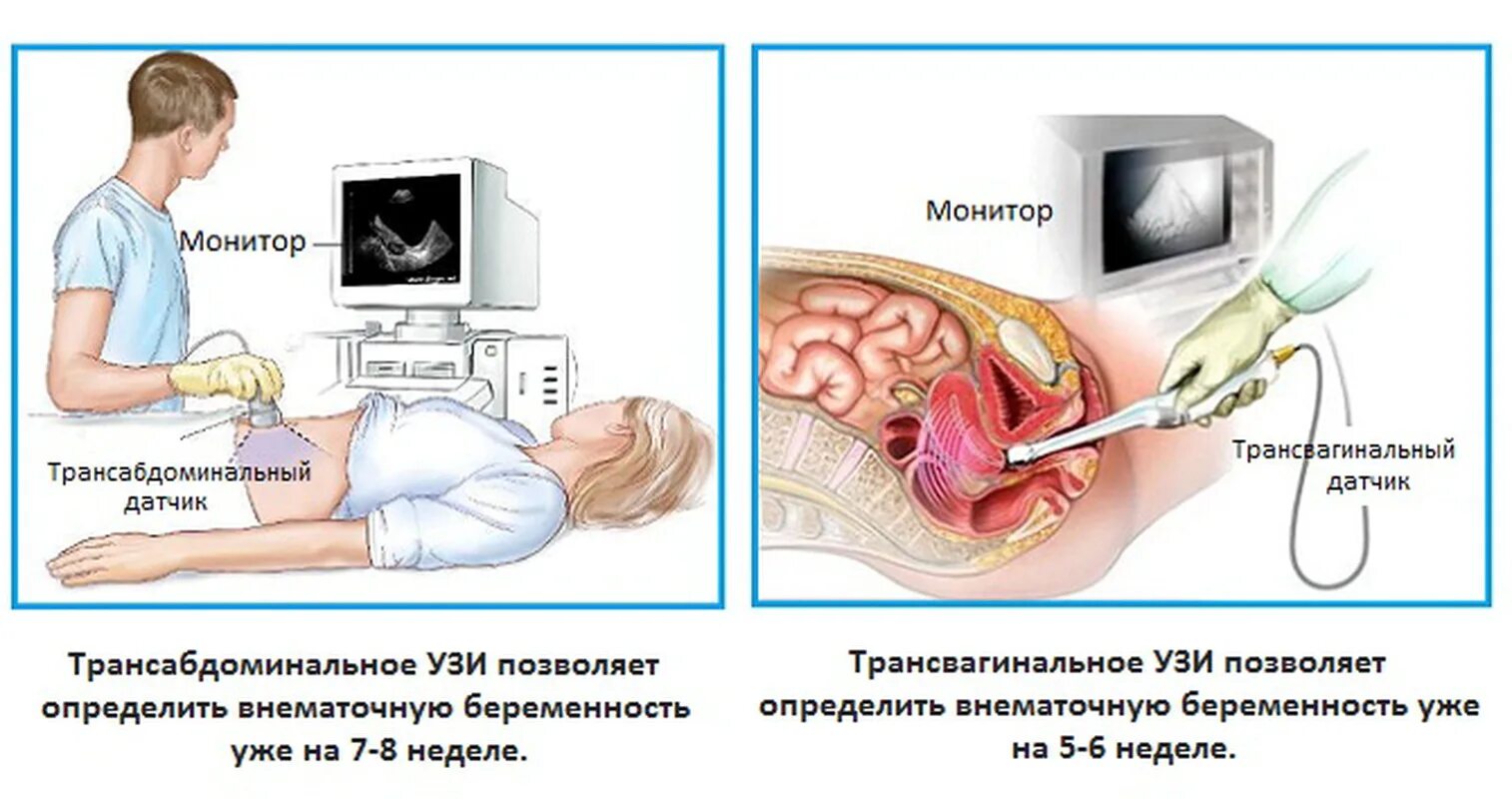 Сможет ли гинеколог