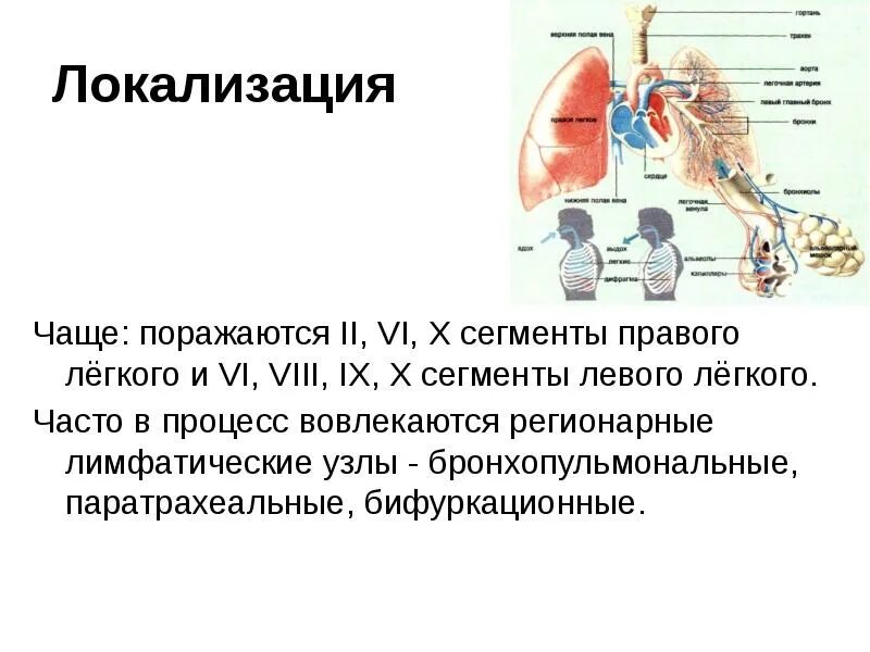 Локализация 13