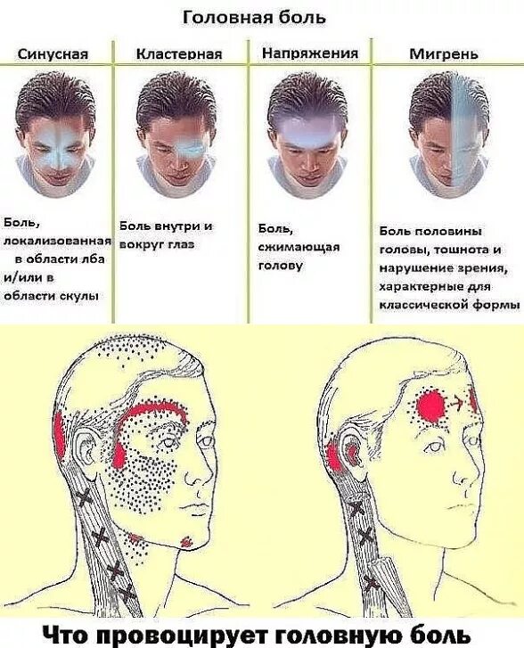 Давление болит голова и глаза. Боли в голове в области. Болит голова в висках. Бтлььв левоц части головы. Головная боль локализация.