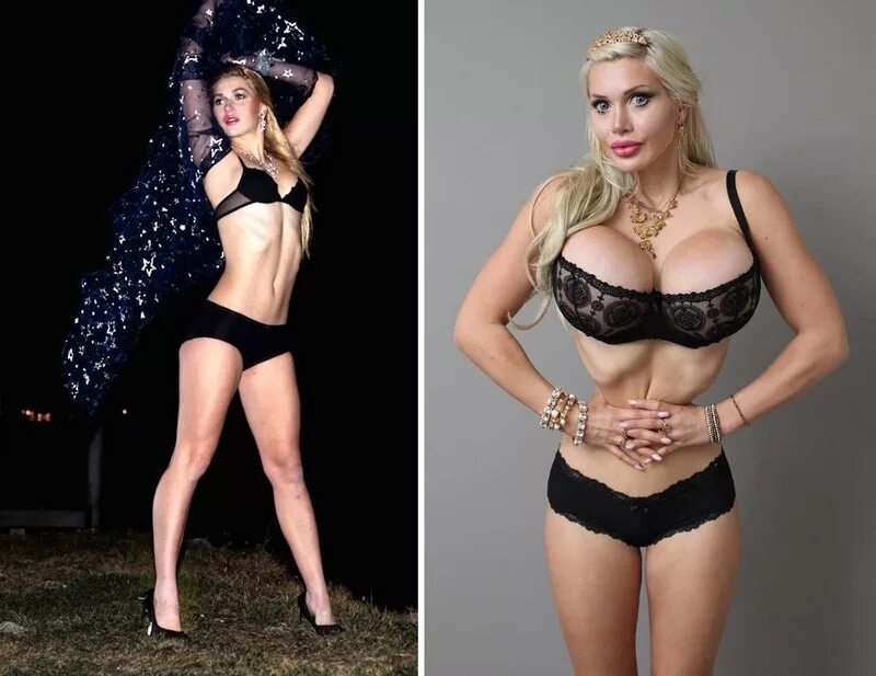 мужчина с удаленными ребрами. мужчина с удаленными ребрами. мужчины удаляют ребра. мужчины удаляют ребра. пикси фокс русалочка.