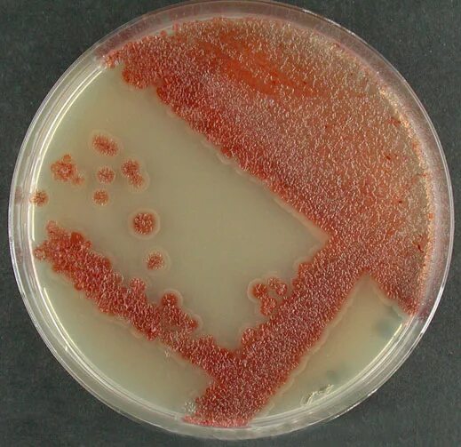 Micrococcus roseus колонии. Sporobolomyces roseus. Sporobolomyces roseus под микроскопом. Micrococcus roseus пигмент. Rothia mucilaginosa