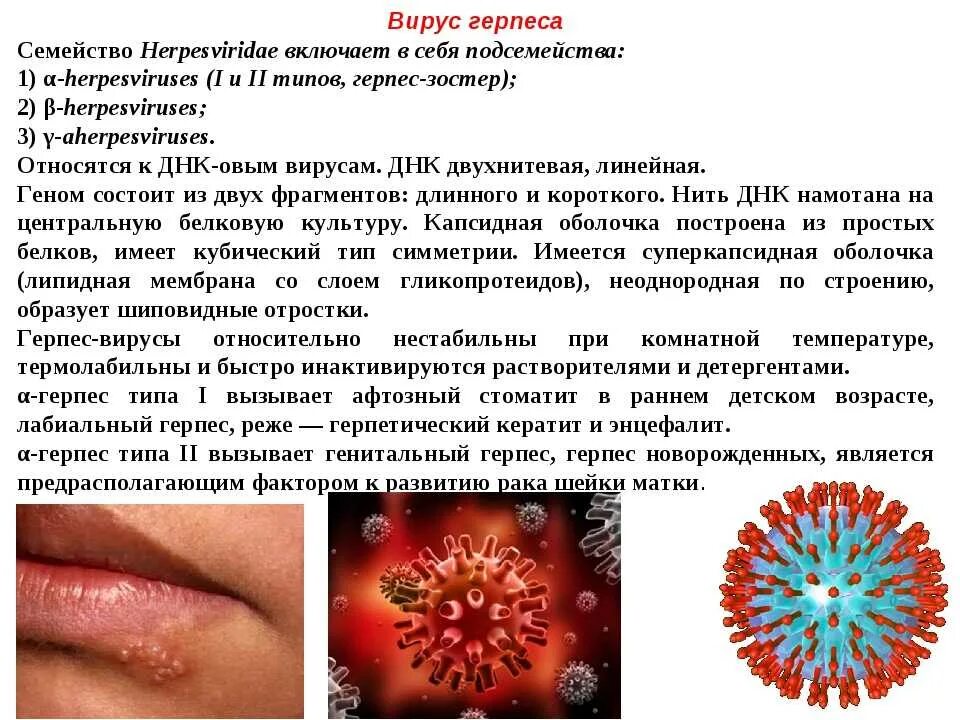 Герп. Профилактика герпесвирусной инфекции. Герпес виды вируса.