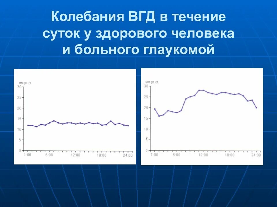 Дважды в течение суток. Суточные колебания внутриглазного давления. Типы суточных колебаний внутриглазного давления. Суточные колебания ВГД В норме и при глаукоме. Пределы нормальных колебаний офтальмотонуса в течение суток.