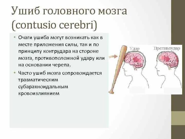 Повреждения головного мозга возникают. Ушиб головного мозга рисунок. Очаг ушиба головного мозга. Ушиб 2 типа головного мозга.