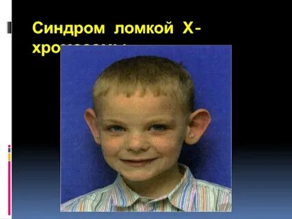 Человек с 1 хромосомой