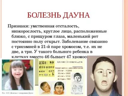 Дети дауны признаки