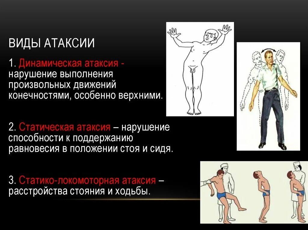 Координация и речь. Локомоторная атаксия. Статическая мозжечковая атаксия. Статодинамическая атаксия. Синдром атаксии неврология.