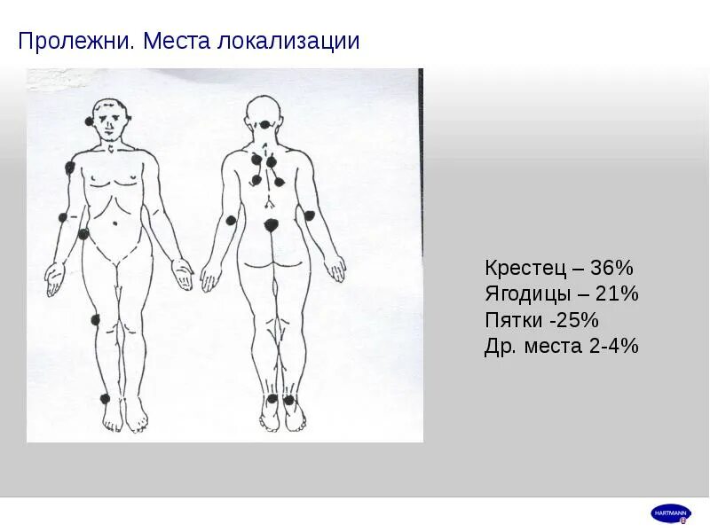 Локализация 13