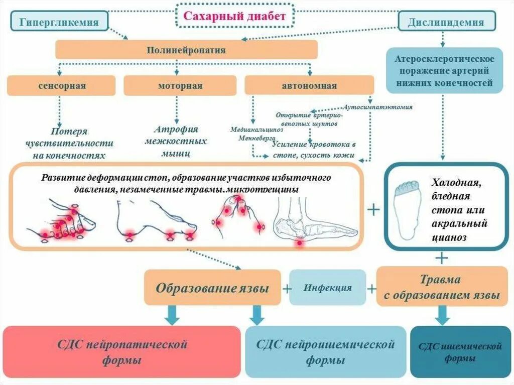 Патогенез развития диабетической стопы. Синдром диабетической стопы патогенез. Схема механизма развития диабетической нейропатии. Терапия схема диабетическая полинейропатия. Типы диабетической полинейропатии