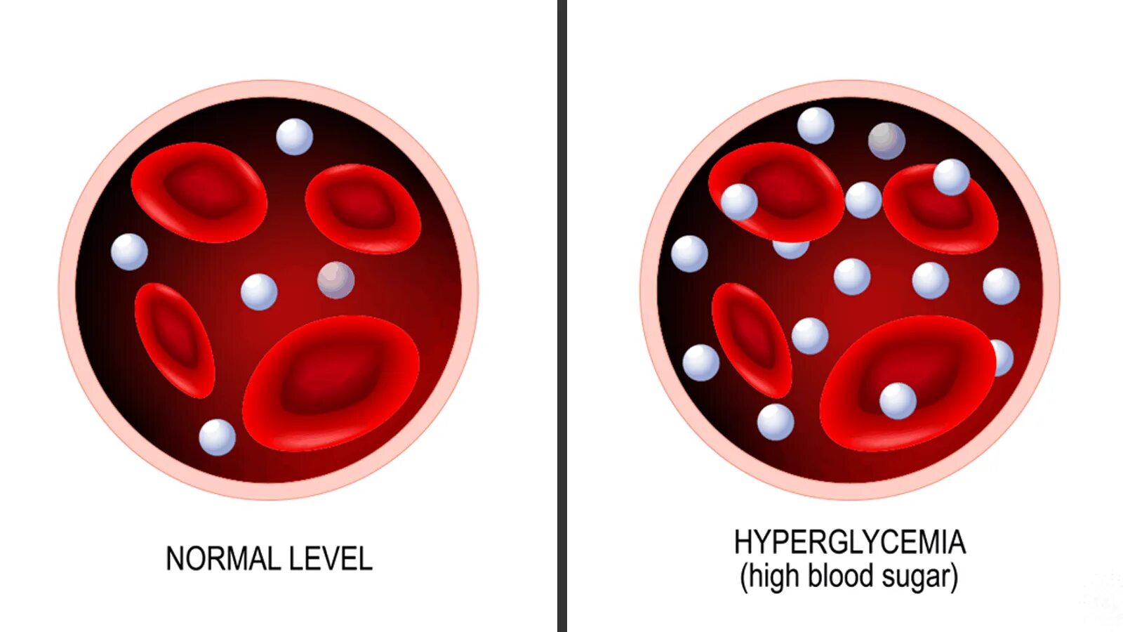 Сахар в крови иллюстрация. Сахар в крови под микроскопом. Уровень сахара в крови картинки.