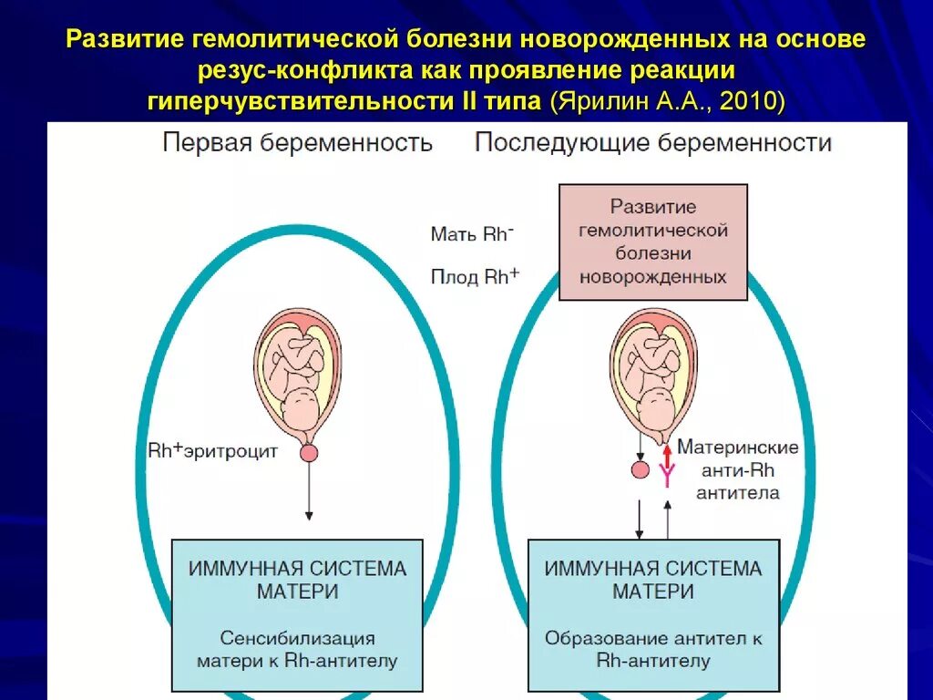 Механизм развития резус конфликта при беременности. Механизм развития резус конфликта схема. Патогенез резус конфликта матери. Резус конфликт гемолитическая болезнь новорожденных. Резус прививка