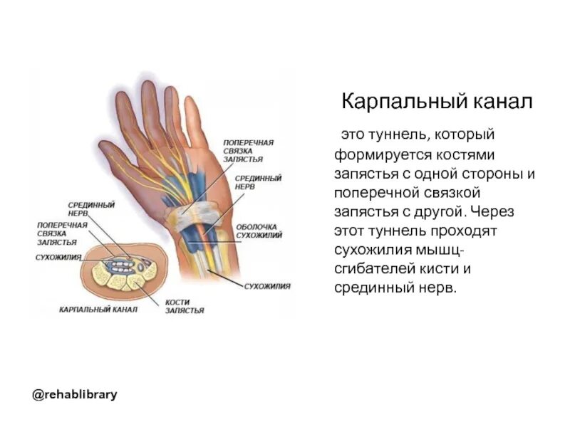 Операция карпального канала кисти. Карпальный синдром лучезапястного сустава. Карпальный туннель запястья анатомия. Карпальный канал кости анатомия. Запястный канал схема.