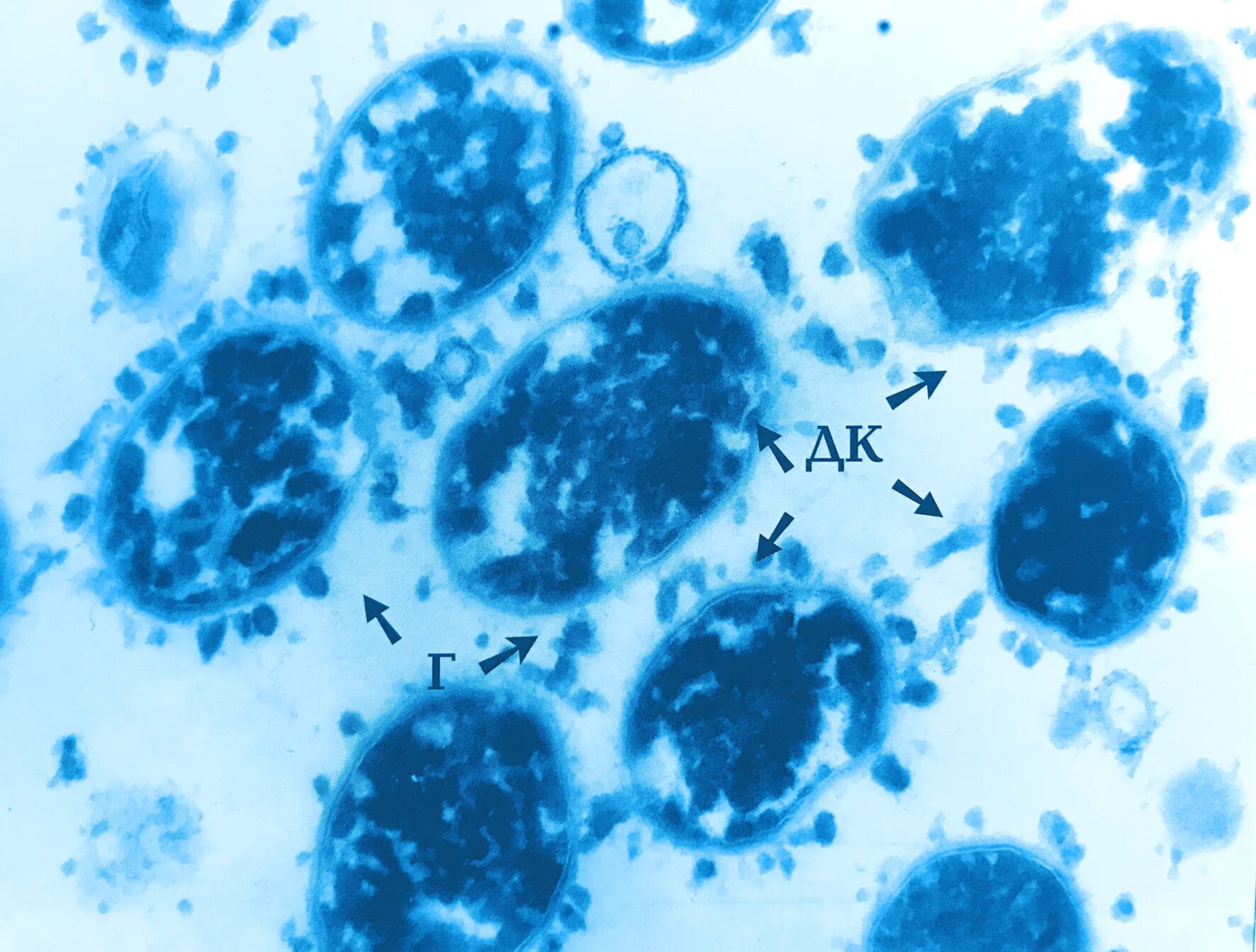 Bacteroides spp что это. Bacteroides fragilis возбудитель. bacteroides fragilis микробиология. бактероиды морфология. бактероиды микробиология.