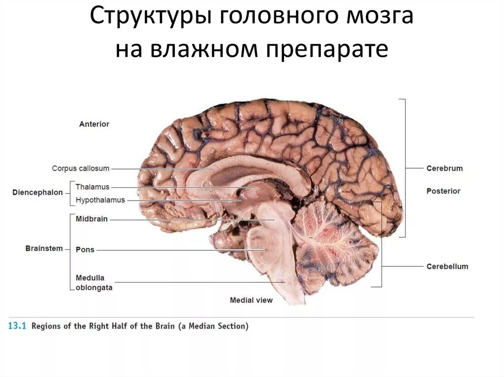 Головного мозга на ранних. Головной мозг строение на латыни. Препарат головного мозга анатомия. Отделы мозга анатомия на латыни.
