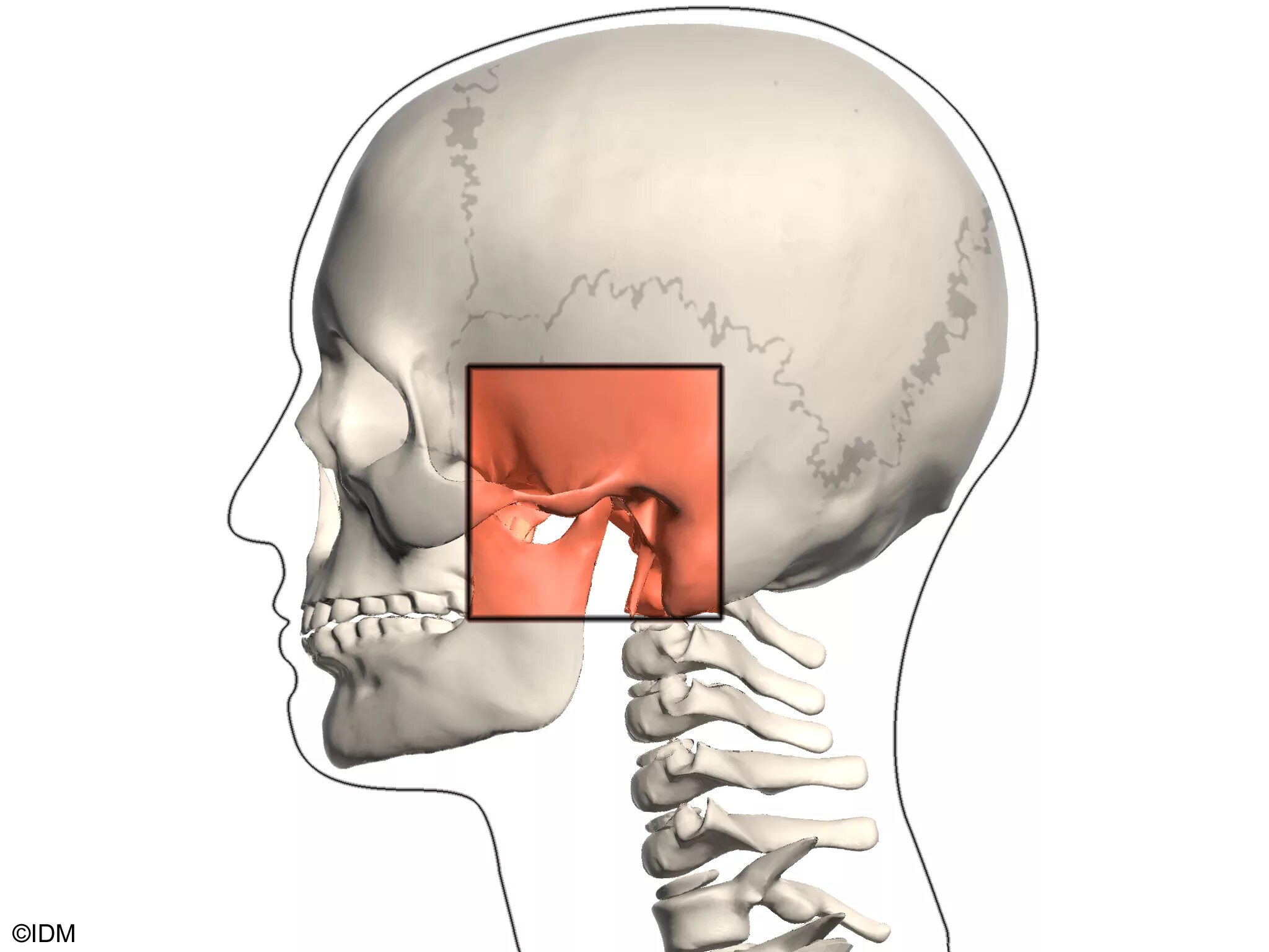 Анкилоз височно-челюстного сустава. Дисфункция челюстного сустава. Челюстно лицевой сустав.
