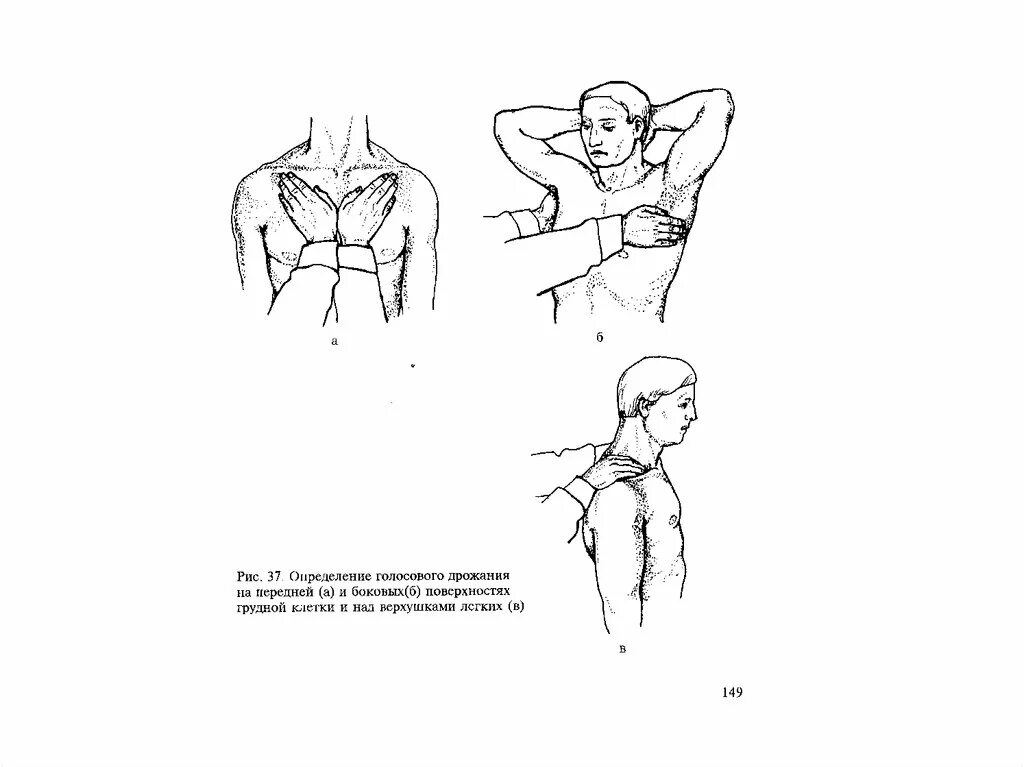 Точки определения голосового дрожания. Техника определения голосового дрожания. Голосовое дрожание методика. Определение голосового дрожания грудной клетки.