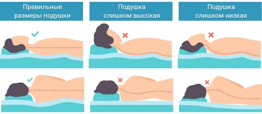 Правильная подушка для сна при шейном остеохондрозе. Правильное положение головы во время сна при шейном остеохондрозе. Правельное положения головы на подушке. Правильное положение головы во сне. Спать без подушки при шейном