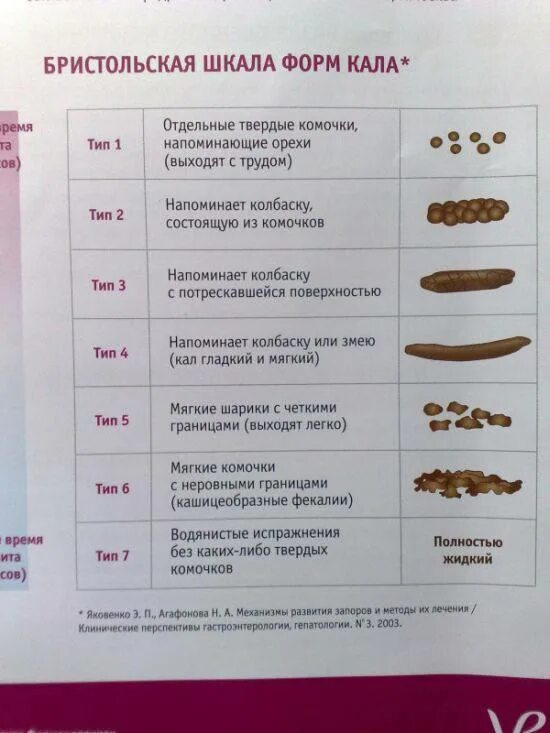 Какой кал должен быть у взрослого человека. Бристольская шкала оценки форм кала. Бристольская шкала стула норма. Бристольская шкала цвета кала. Нормальный вид кала.