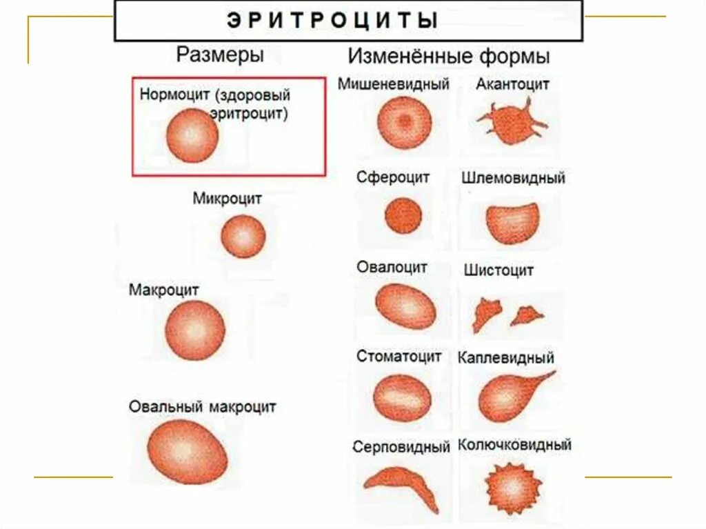 Эритроциты что это значит у женщин. Изменение формы и размеров эритроцитов. Патологические формы эритроцитов таблица. Патологические изменения формы эритроцитов. Классификация патологических форм эритроцитов.