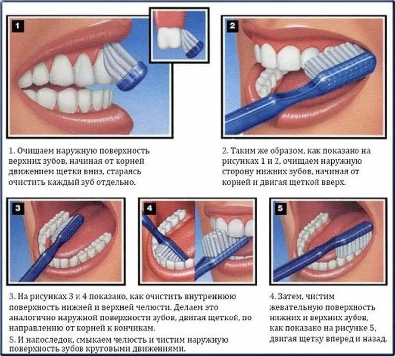 Плюсы чистки зубов. Схема правильной чистки зубов. Методы чистки зубов стандартный метод чистки зубов. Правильная методика чистки зубов зубной щёткой. Памятка о правильной чистке зубов.
