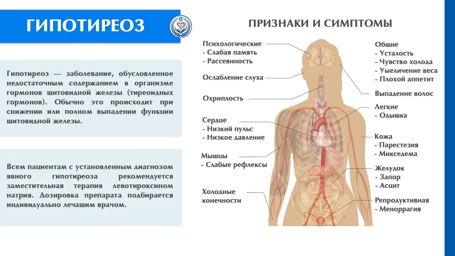 Лечение гипотиреоза без гормонов. Пульс при гипотиреозе. Гипотиреоз частота заболеваний. Гипотиреоз потливость. Гипотиреоз симптомы у женщин.