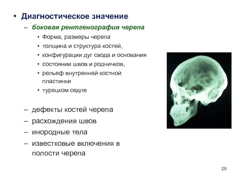 Полости в костях черепа. Пластика костей свода черепа. ПОСТТРЕПАНАЦИОННЫЙ дефект черепа рентген. Пластика дефектов костей свода черепа.